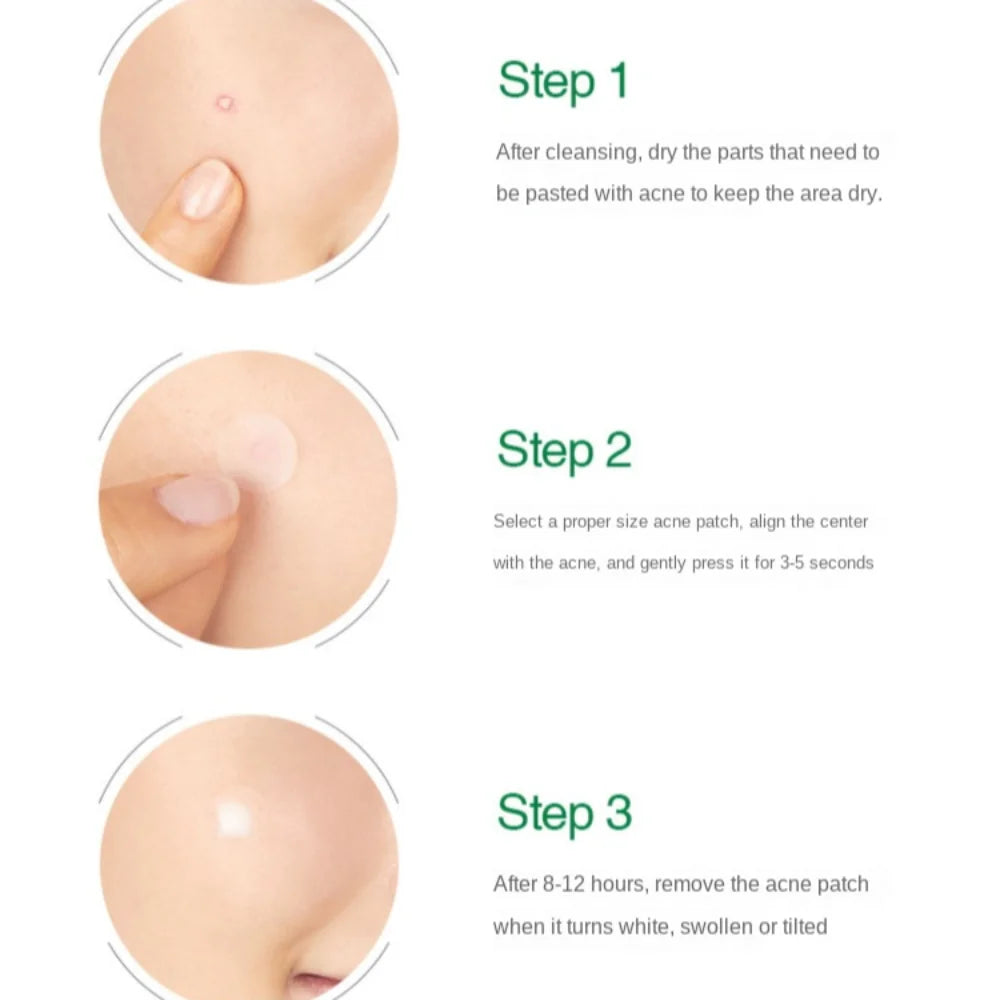 Clear Pimple Patch
